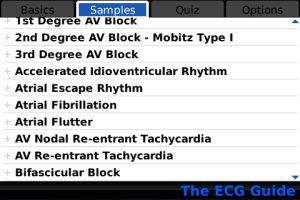 ECG Guide