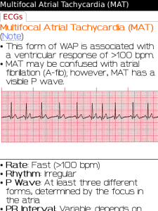 ECG Notes: Interpretation and Management Guide for blackberry app Screenshot